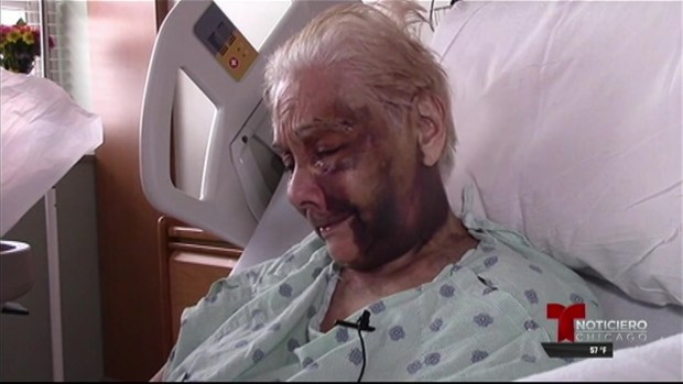 La cobarde agresión a un hombre de 90 años