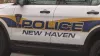 Arrestan a padre de bebé de 3 meses que sostuvo lesiones críticas en New Haven