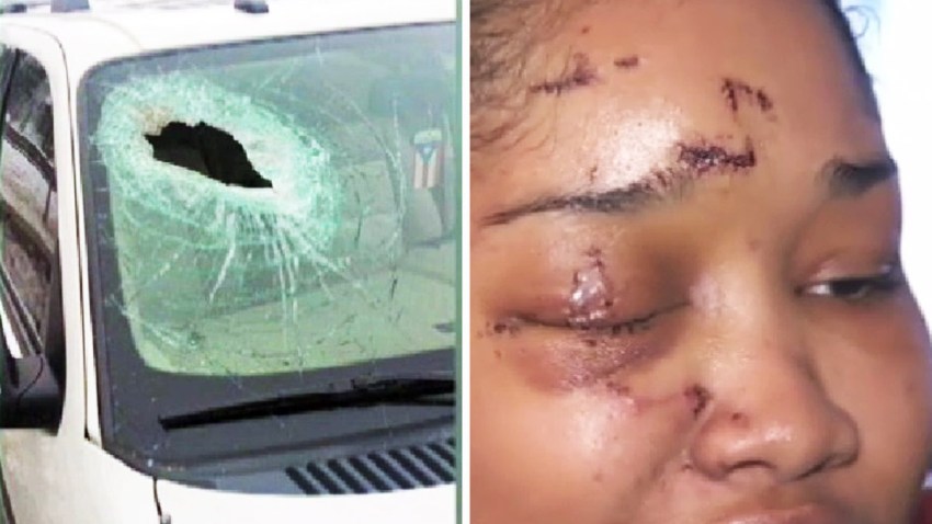 TLMD-mujer-casi-pierde-un-ojo-al-conducir-st