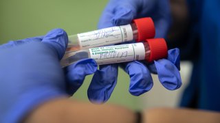 A nurse holds COVID-19 swab tests at a clinic on May 5, 2020 in Stamford, Connecticut. The state has completed more than one million tests as of August.