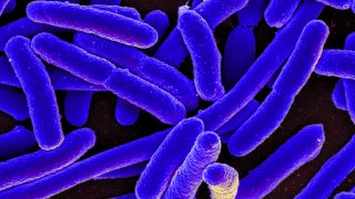 Micrografía electrónica de barrido coloreada de Escherichia coli, cultivada y adherida a un cubreobjetos.