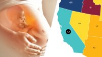 El aborto y tus derechos: mapa interactivo explica las leyes en cada estado