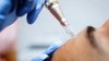 CDC detallan los primeros casos de VIH transmitido a través de “faciales de vampiro” en EEUU