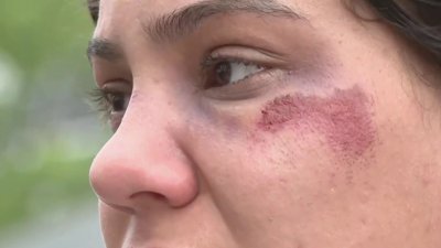 Mujer que habría agredido a hombre con un tacón en Providence alega defensa propia