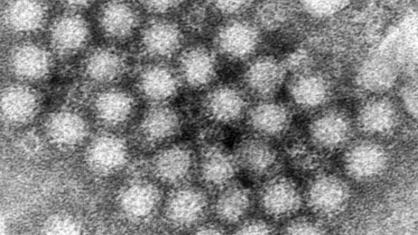 ARCHIVO – Esta imagen de microscopio electrónico facilitada por los Centros para el Control y la Prevención de Enfermedades de Estados Unidos (CDC, por sus siglas en inglés) muestra un grupo de viriones de norovirus. (Charles D. Humphrey/CDC vía AP, Archivo)